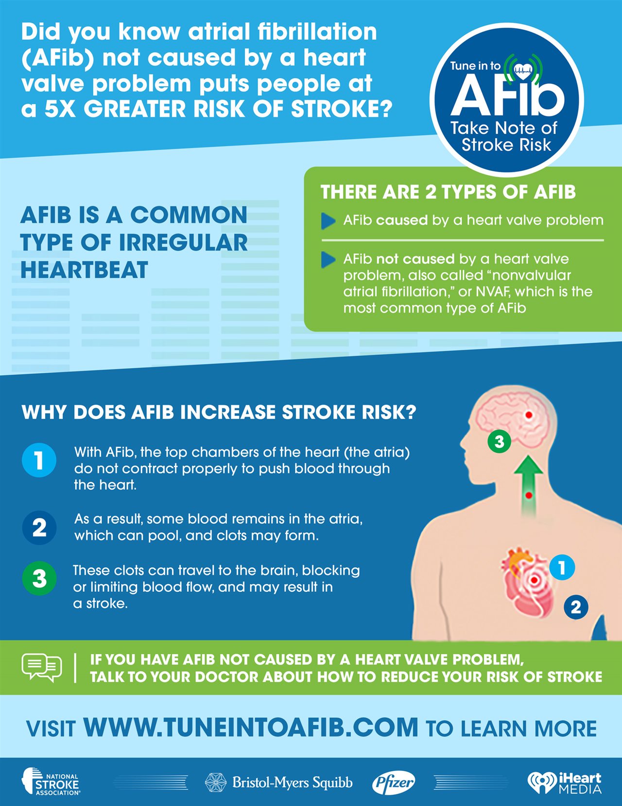 Tune in to AFib, Take Note of Stroke Risk [Infographic] – Hatter Network