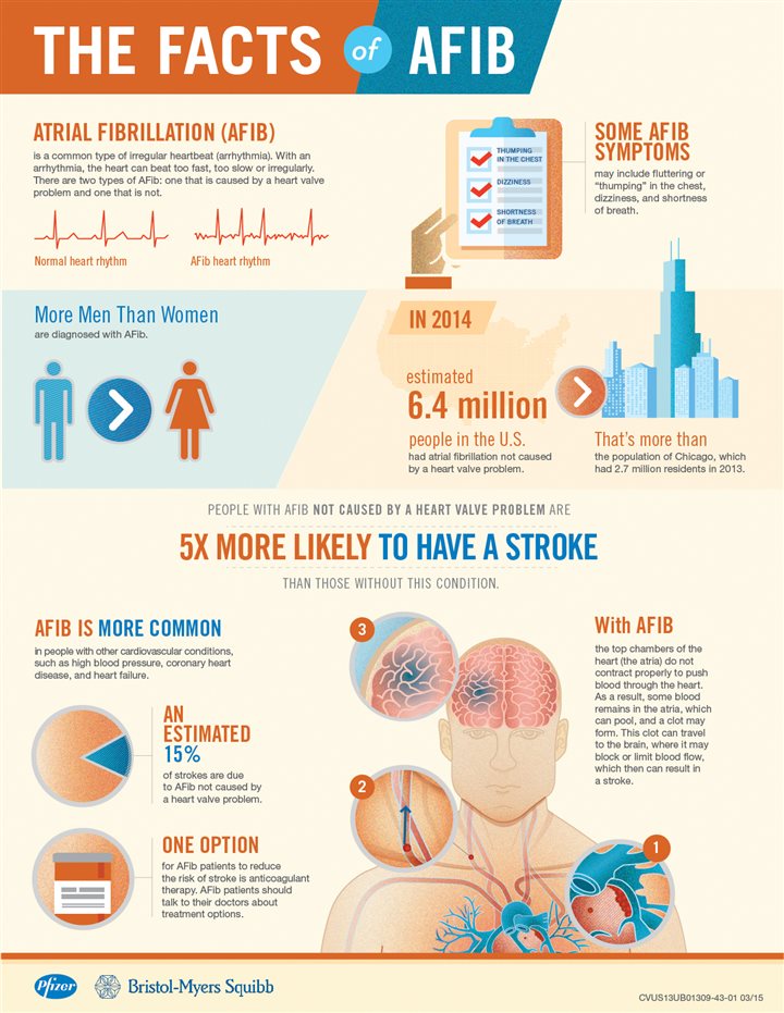 The Facts of AFib [Infographic] – Chicago Tribune