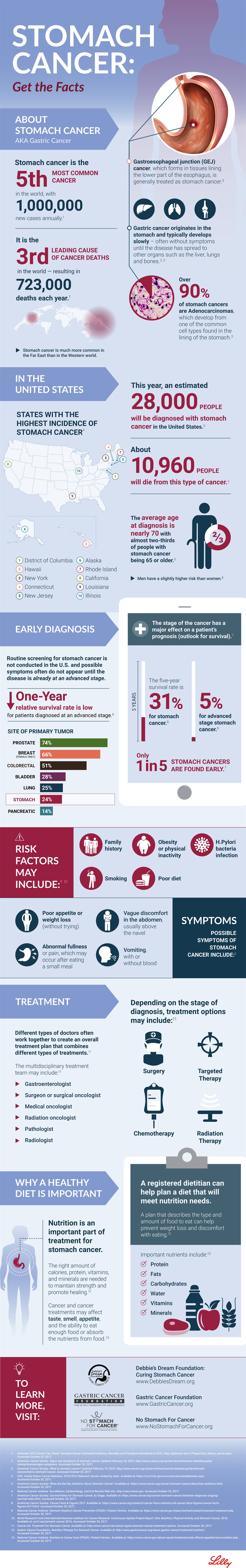 Stomach Cancer: Get the Facts (Infographic) – Orlando Sentinel