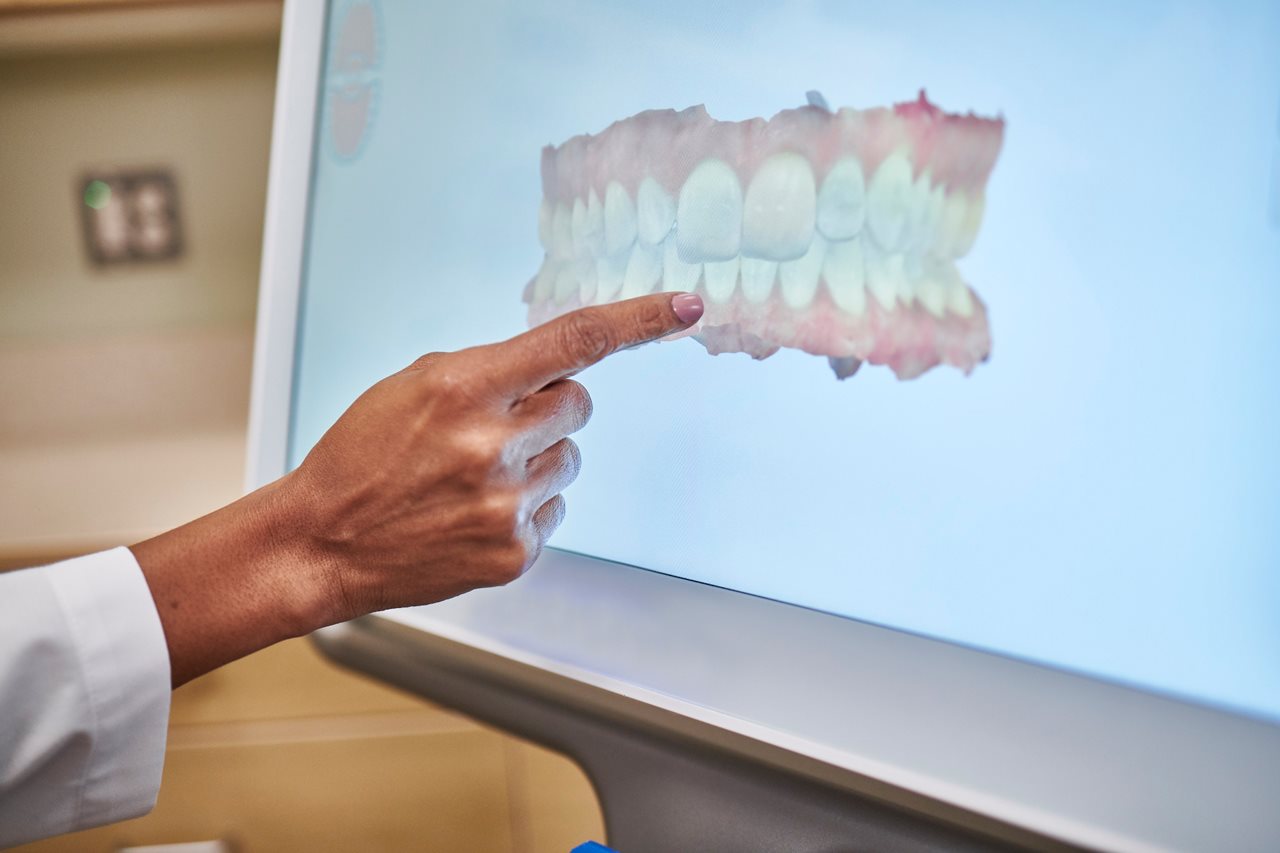 Set of teeth on a screen with a dentist pointing to an area of concern.